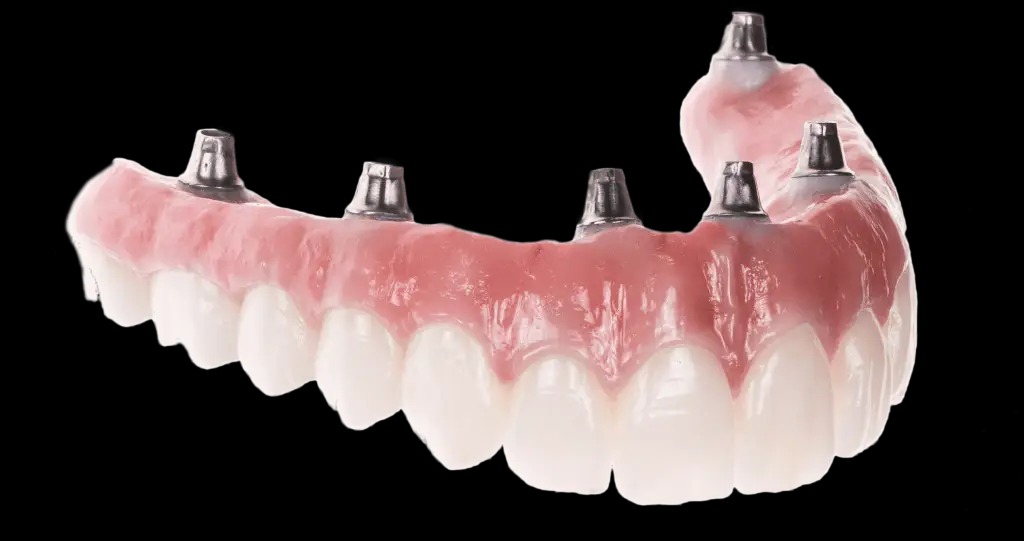 The Benefits Of Invisalign Over Traditional Braces